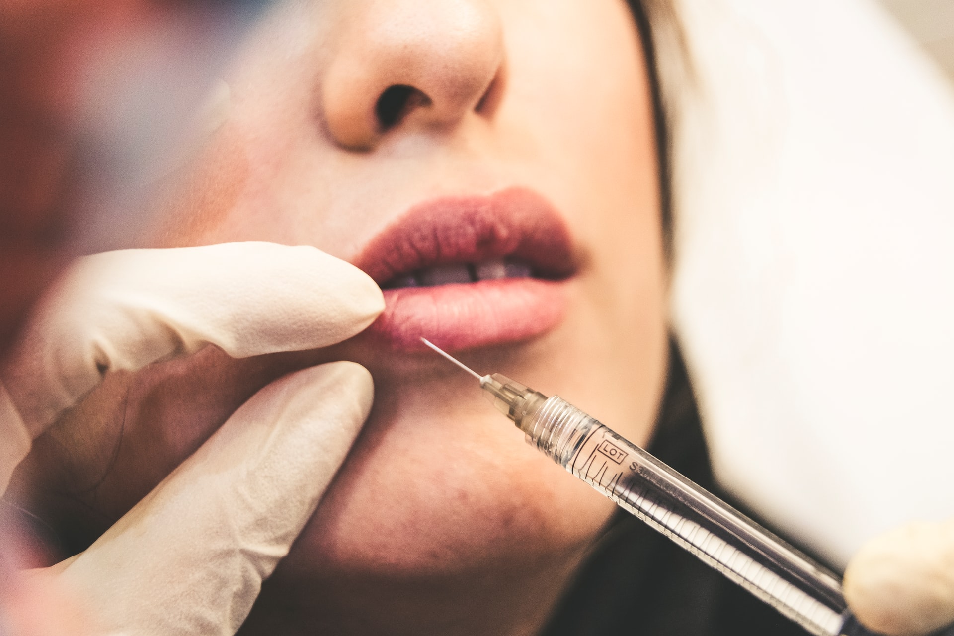 Botox et migraine 1